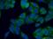 Putative peptidyl-tRNA hydrolase PTRHD1 antibody, 25576-1-AP, Proteintech Group, Immunofluorescence image 
