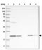 Transmembrane Protein 199 antibody, PA5-55496, Invitrogen Antibodies, Western Blot image 