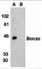 C-X-C Motif Chemokine Receptor 6 antibody, 2209, ProSci, Western Blot image 