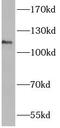 Anoctamin 3 antibody, FNab00443, FineTest, Western Blot image 