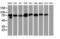 Signal Transducer And Activator Of Transcription 5A antibody, M01087-2, Boster Biological Technology, Western Blot image 
