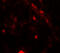 Phosphoinositide-3-Kinase Regulatory Subunit 4 antibody, 7949, ProSci, Immunofluorescence image 