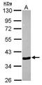 Annexin A10 antibody, GTX115600, GeneTex, Western Blot image 