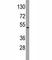 Integrin Linked Kinase antibody, F50638-0.4ML, NSJ Bioreagents, Immunohistochemistry paraffin image 