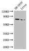 Choline O-Acetyltransferase antibody, CSB-PA005314LA01HU, Cusabio, Western Blot image 