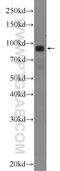 Diacylglycerol kinase beta antibody, 24320-1-AP, Proteintech Group, Western Blot image 