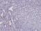 c-Kit antibody, M01335-2, Boster Biological Technology, Immunohistochemistry paraffin image 