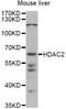 Histone Deacetylase 2 antibody, LS-C748657, Lifespan Biosciences, Western Blot image 