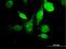 Hyaluronidase 3 antibody, H00008372-B01P, Novus Biologicals, Immunofluorescence image 