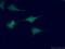 Oligophrenin 1 antibody, 11076-1-AP, Proteintech Group, Immunofluorescence image 