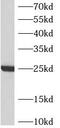 ATP Synthase Peripheral Stalk-Membrane Subunit B antibody, FNab00707, FineTest, Western Blot image 