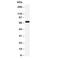 Solute Carrier Family 6 Member 4 antibody, R30795, NSJ Bioreagents, Western Blot image 