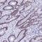 KLF14 antibody, NBP1-92058, Novus Biologicals, Immunohistochemistry paraffin image 