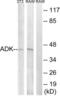 Adenosine Kinase antibody, LS-C118947, Lifespan Biosciences, Western Blot image 