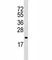 ADP Ribosylation Factor 5 antibody, F45323-0.4ML, NSJ Bioreagents, Western Blot image 