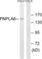 Patatin Like Phospholipase Domain Containing 6 antibody, abx014663, Abbexa, Western Blot image 