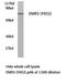 Adhesion G Protein-Coupled Receptor E3 antibody, LS-C177085, Lifespan Biosciences, Western Blot image 