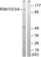 Ribosomal Protein S6 Kinase A1 antibody, LS-C199552, Lifespan Biosciences, Western Blot image 