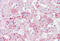 Alpha Fetoprotein antibody, MBS244768, MyBioSource, Immunohistochemistry frozen image 