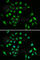 Component Of Inhibitor Of Nuclear Factor Kappa B Kinase Complex antibody, A2062, ABclonal Technology, Immunofluorescence image 