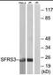 Serine And Arginine Rich Splicing Factor 3 antibody, orb95129, Biorbyt, Western Blot image 