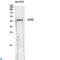 Somatostatin Receptor 2 antibody, LS-C813510, Lifespan Biosciences, Western Blot image 