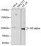 Component Of Inhibitor Of Nuclear Factor Kappa B Kinase Complex antibody, 18-473, ProSci, Western Blot image 