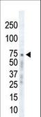 G Protein-Coupled Receptor Kinase 2 antibody, LS-C98902, Lifespan Biosciences, Western Blot image 