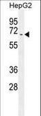 UDP-N-Acetylglucosamine Pyrophosphorylase 1 antibody, LS-C157306, Lifespan Biosciences, Western Blot image 