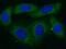 Poly(ADP-Ribose) Polymerase Family Member 10 antibody, FNab06153, FineTest, Immunofluorescence image 