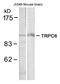 Transient Receptor Potential Cation Channel Subfamily C Member 6 antibody, 79-629, ProSci, Western Blot image 
