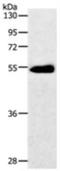 Solute carrier family 2, facilitated glucose transporter member 3 antibody, NBP2-36485, Novus Biologicals, Western Blot image 