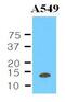 Cystatin-B antibody, GTX53707, GeneTex, Western Blot image 