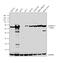 Aldehyde Dehydrogenase 1 Family Member A1 antibody, PA5-32127, Invitrogen Antibodies, Western Blot image 