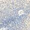 CD70 antigen antibody, GTX53916, GeneTex, Immunohistochemistry paraffin image 