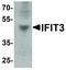Interferon Induced Protein With Tetratricopeptide Repeats 3 antibody, LS-C336159, Lifespan Biosciences, Western Blot image 