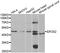 Eukaryotic Translation Initiation Factor 2 Subunit Beta antibody, TA332975, Origene, Western Blot image 