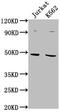 Proteasome 26S Subunit, Non-ATPase 6 antibody, CSB-PA614875PA01HU, Cusabio, Western Blot image 