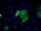 Sterol O-Acyltransferase 2 antibody, NBP2-02588, Novus Biologicals, Immunocytochemistry image 