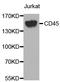 CD45 antibody, STJ25231, St John