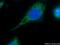 Mitochondrial Ribosomal Protein L45 antibody, 15682-1-AP, Proteintech Group, Immunofluorescence image 