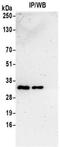 VAMP Associated Protein A antibody, NBP2-32249, Novus Biologicals, Immunoprecipitation image 
