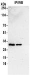 VAMP Associated Protein A antibody, NBP2-32249, Novus Biologicals, Immunoprecipitation image 