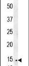 Cysteine Rich C-Terminal 1 antibody, PA5-23539, Invitrogen Antibodies, Western Blot image 