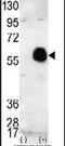 RAC-beta serine/threonine-protein kinase antibody, PA5-13760, Invitrogen Antibodies, Western Blot image 