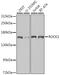 Rho Associated Coiled-Coil Containing Protein Kinase 1 antibody, GTX32843, GeneTex, Western Blot image 