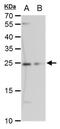 ETHE1 Persulfide Dioxygenase antibody, MA5-27829, Invitrogen Antibodies, Western Blot image 