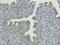 ATP Binding Cassette Subfamily B Member 1 antibody, orb340143, Biorbyt, Immunohistochemistry paraffin image 