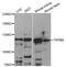 Transient Receptor Potential Cation Channel Subfamily M Member 8 antibody, LS-C747669, Lifespan Biosciences, Western Blot image 