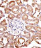 Sphingosine Kinase 1 antibody, 62-749, ProSci, Immunohistochemistry paraffin image 